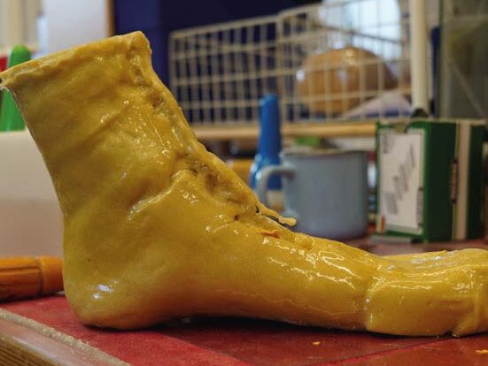 FOAMING WITH ASTI-OP – TERASKE SANITÄTSHAUS 3.12 e1745501909294 BEIL Kunststoffproduktions- und Handelsgesellschaft mbH